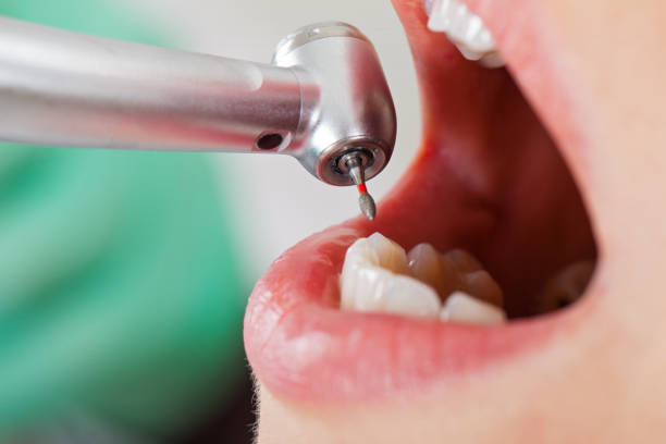 Best Urgent Care for Lost Fillings or Crowns in Hodgkins, IL